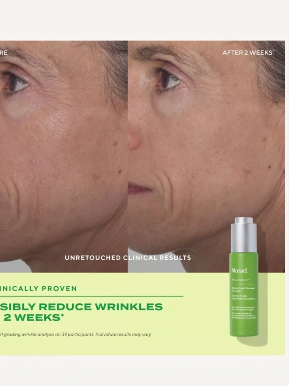 Murad Resurgence Retinol Youth Renewal Oil Drops — Green